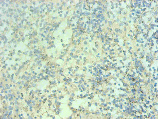 S100A9 / MRP14 Antibody - Immunohistochemical of paraffin-embedded human spleen tissue using S100A9 Monoclonal Antibody at dilution of 1:200