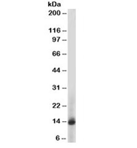 S100A9 / MRP14 Antibody - Western blot testing of human PBM lysate with S100A9 antibody (clone 47-8D3). This image was taken for the unmodified form of this product. Other forms have not been tested.