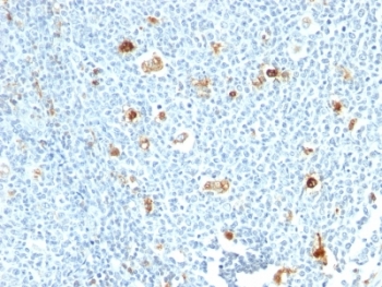 S100A9 / MRP14 Antibody - Formalin-fixed, paraffin-embedded human tonsil stained with Calprotectin antibody (CPT/1028).  This image was taken for the unmodified form of this product. Other forms have not been tested.