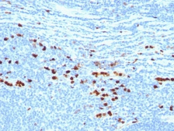 S100A9 / MRP14 Antibody - Formalin-fixed, paraffin-embedded human tonsil stained with MRP8 + MPR14 protein antibody (MAC387).  This image was taken for the unmodified form of this product. Other forms have not been tested.