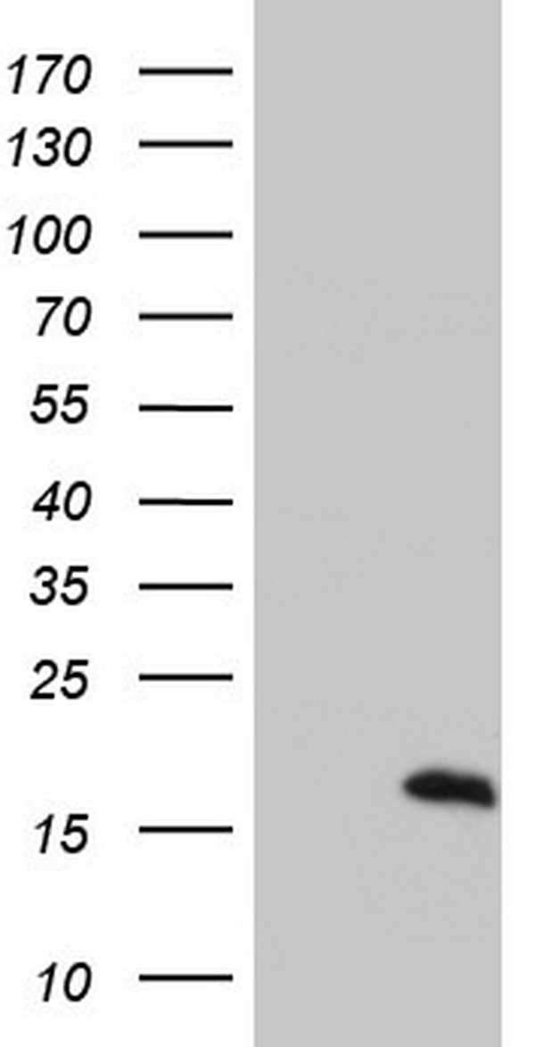 S100A9 / MRP14 Antibody - HEK293T cells were transfected with the pCMV6-ENTRY control (Left lane) or pCMV6-ENTRY S100A9 (Right lane) cDNA for 48 hrs and lysed. Equivalent amounts of cell lysates (5 ug per lane) were separated by SDS-PAGE and immunoblotted with anti-S100A9.