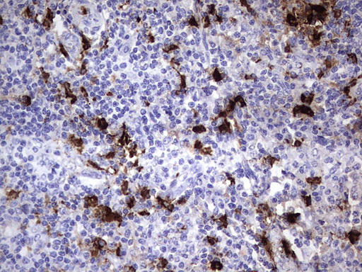 S100A9 / MRP14 Antibody - IHC of paraffin-embedded Human lymph node tissue using anti-S100A9 mouse monoclonal antibody. (Heat-induced epitope retrieval by 1 mM EDTA in 10mM Tris, pH8.5, 120°C for 3min).