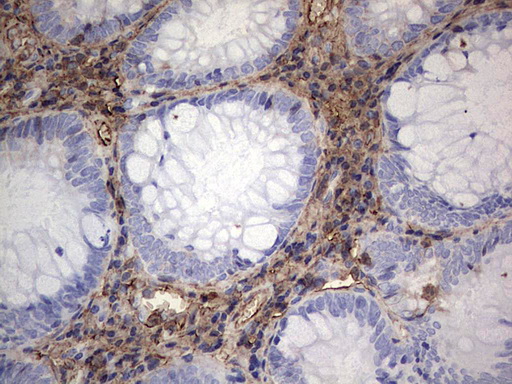 S100A9 / MRP14 Antibody - Immunohistochemical staining of paraffin-embedded Human colon tissue within the normal limits using anti-S100A9 mouse monoclonal antibody. (Heat-induced epitope retrieval by 1 mM EDTA in 10mM Tris, pH8.5, 120C for 3min,