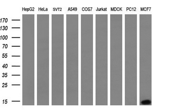 S100A9 / MRP14 Antibody - Western blot analysis of extracts. (35ug) from 9 different cell lines by using anti-S100A9 monoclonal antibody. (HepG2: human; HeLa: human; SVT2: mouse; A549: human; COS7: monkey; Jurkat: human; MDCK: canine;rat; MCF7: human). (1:200)