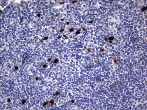 S100A9 / MRP14 Antibody - Immunohistochemical staining of paraffin-embedded Human tonsil within the normal limits using anti-S100A9 mouse monoclonal antibody. (Heat-induced epitope retrieval by 1 mM EDTA in 10mM Tris, pH8.5, 120C for 3min,