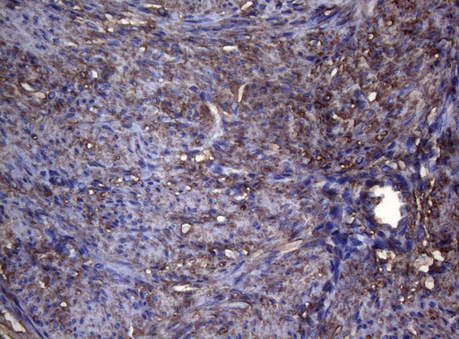 S100A9 / MRP14 Antibody - Immunohistochemical staining of paraffin-embedded Human endometrium tissue within the normal limits using anti-S100A9 mouse monoclonal antibody. (Heat-induced epitope retrieval by 1mM EDTA in 10mM Tris buffer. (pH8.5) at 120°C for 3 min. (1:150)