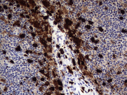 S100A9 / MRP14 Antibody - IHC of paraffin-embedded Human lymph node tissue using anti-S100A9 mouse monoclonal antibody. (Heat-induced epitope retrieval by 1 mM EDTA in 10mM Tris, pH8.5, 120°C for 3min).