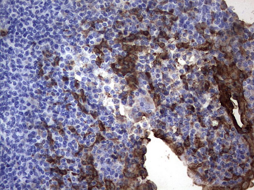 S100A9 / MRP14 Antibody - IHC of paraffin-embedded Human tonsil using anti-S100A9 mouse monoclonal antibody. (Heat-induced epitope retrieval by 1 mM EDTA in 10mM Tris, pH8.5, 120°C for 3min).