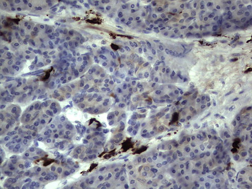 S100A9 / MRP14 Antibody - Immunohistochemical staining of paraffin-embedded Human pancreas tissue within the normal limits using anti-S100A9 mouse monoclonal antibody. (Heat-induced epitope retrieval by 1 mM EDTA in 10mM Tris, pH8.5, 120C for 3min,