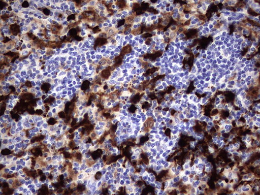 S100A9 / MRP14 Antibody - Immunohistochemical staining of paraffin-embedded Human lymph node tissue within the normal limits using anti-S100A9 mouse monoclonal antibody. (Heat-induced epitope retrieval by 1 mM EDTA in 10mM Tris, pH8.5, 120C for 3min,