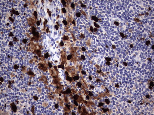 S100A9 / MRP14 Antibody - Immunohistochemical staining of paraffin-embedded Human lymph node tissue within the normal limits using anti-S100A9 mouse monoclonal antibody. (Heat-induced epitope retrieval by 1 mM EDTA in 10mM Tris, pH8.5, 120C for 3min,