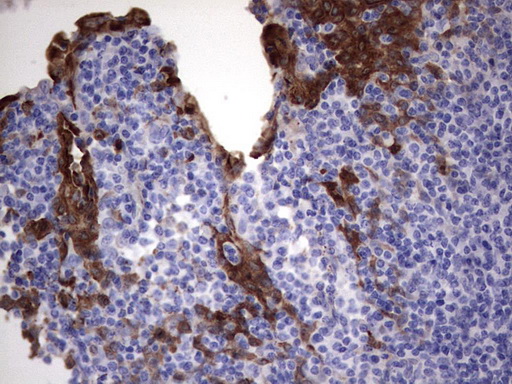 S100A9 / MRP14 Antibody - Immunohistochemical staining of paraffin-embedded Human tonsil within the normal limits using anti-S100A9 mouse monoclonal antibody. (Heat-induced epitope retrieval by 1 mM EDTA in 10mM Tris, pH8.5, 120C for 3min,