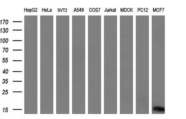 S100A9 / MRP14 Antibody - Western blot analysis of extracts. (35ug) from 9 different cell lines by using anti-S100A9 monoclonal antibody. (HepG2: human; HeLa: human; SVT2: mouse; A549: human; COS7: monkey; Jurkat: human; MDCK: canine;rat; MCF7: human). (1:200)