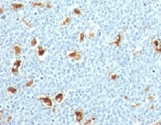 S100A9 / MRP14 Antibody - Formalin-fixed, paraffin-embedded human tonsil stained with S100A9 antibody.  This image was taken for the unmodified form of this product. Other forms have not been tested.