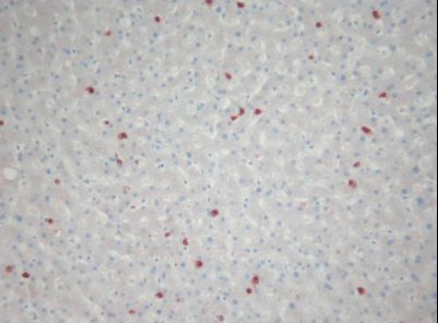 S100A9 / MRP14 Antibody - IHC of MRP14 / S100A9 antibody. Formalin-fixed, paraffin-embedded human liver.