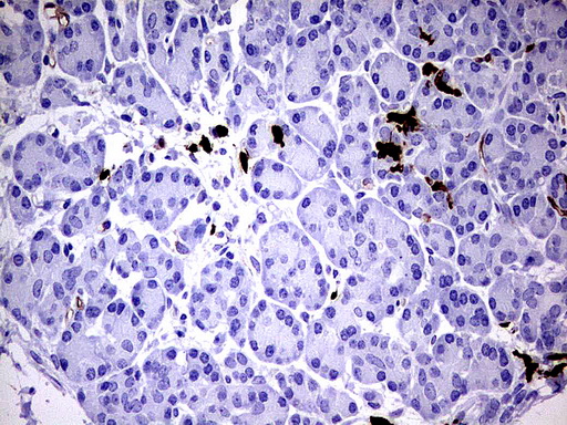 S100A9 / MRP14 Antibody - Immunohistochemical staining of paraffin-embedded Human pancreas tissue using anti-S100A9 mouse monoclonal antibody.  heat-induced epitope retrieval by 1 mM EDTA in 10mM Tris, pH8.0, 120C for 3min)