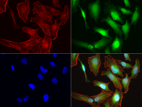 S100A9 / MRP14 Antibody - Immunofluorescent staining of HeLa cells using anti-S100A9 mouse monoclonal antibody  green, 1:50). Actin filaments were labeled with Alexa Fluor® 594 Phalloidin. (red), and nuclear with DAPI. (blue).
