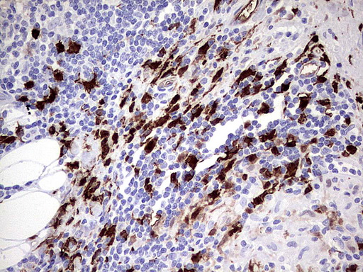 S100A9 / MRP14 Antibody - Immunohistochemical staining of paraffin-embedded Human lymph node tissue using anti-S100A9 mouse monoclonal antibody.  heat-induced epitope retrieval by 1 mM EDTA in 10mM Tris, pH8.0, 120C for 3min)