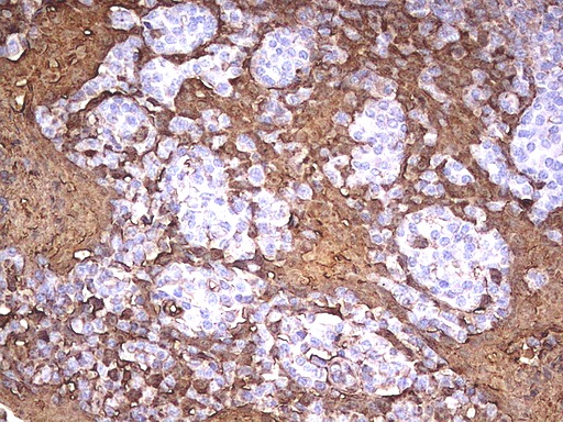 S100A9 / MRP14 Antibody - Immunohistochemical staining of paraffin-embedded Human tonsil using anti-S100A9 mouse monoclonal antibody.  heat-induced epitope retrieval by 1 mM EDTA in 10mM Tris, pH8.0, 120C for 3min)