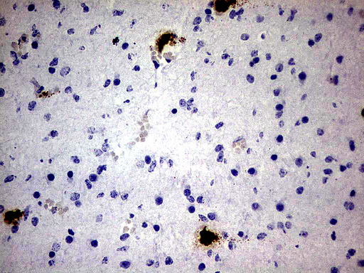 S100A9 / MRP14 Antibody - Immunohistochemical staining of paraffin-embedded Human embryonic cerebellum using anti-S100A9 mouse monoclonal antibody.  heat-induced epitope retrieval by 1 mM EDTA in 10mM Tris, pH8.0, 120C for 3min)