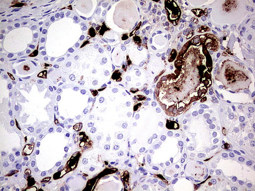 S100A9 / MRP14 Antibody - Immunohistochemical staining of paraffin-embedded Human Kidney tissue using anti-S100A9 mouse monoclonal antibody.  heat-induced epitope retrieval by 1 mM EDTA in 10mM Tris, pH8.0, 120C for 3min)