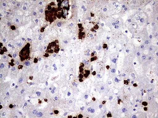 S100A9 / MRP14 Antibody - Immunohistochemical staining of paraffin-embedded Human liver tissue using anti-S100A9 mouse monoclonal antibody.  heat-induced epitope retrieval by 1 mM EDTA in 10mM Tris, pH8.0, 120C for 3min)