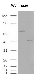 S100A9 / MRP14 Antibody - S100A9 antibody - cells were transfected with the pCMV6-ENTRY control or pCMV6-ENTRY S100A9 cDNA for 48 hrs and lysed. Equivalent amounts of cell lysates (5 ug per lane) were separated by SDS-PAGE and immunoblotted with anti-S100A9.