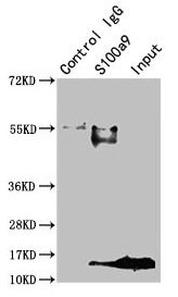 S100A9 / MRP14 Antibody - Immunoprecipitating S100A9 in Mouse spleen tissue Lane 1: Rabbit control IgG instead of S100a9 Antibody in Mouse spleen tissue.For western blotting, a HRP-conjugated Protein G antibody was used as the secondary antibody (1/2000) Lane 2: S100a9 Antibody (8µg) + Mouse spleen tissue (500µg) Lane 3: Mouse spleen tissue (10µg)