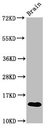 S100A9 / MRP14 Antibody - Western Blot Positive WB detected in: Mouse brain tissue All lanes: S100A9 antibody at 3.9µg/ml Secondary Goat polyclonal to rabbit IgG at 1/50000 dilution Predicted band size: 14 kDa Observed band size: 14 kDa