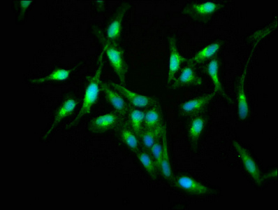 S100A9 / MRP14 Antibody - Immunofluorescence staining of Hela cells with S100A9 Antibody at 1:133, counter-stained with DAPI. The cells were fixed in 4% formaldehyde, permeabilized using 0.2% Triton X-100 and blocked in 10% normal Goat Serum. The cells were then incubated with the antibody overnight at 4°C. The secondary antibody was Alexa Fluor 488-congugated AffiniPure Goat Anti-Rabbit IgG(H+L).
