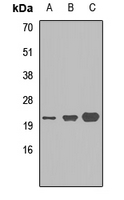S100A9 / MRP14 Antibody