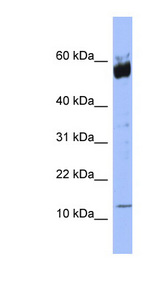 S100A9 / MRP14 Antibody - S100A9 / MRP14 antibody Western blot of HeLa lysate. This image was taken for the unconjugated form of this product. Other forms have not been tested.