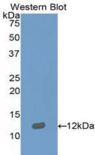 S100B / S100 Beta Antibody - Western blot of recombinant S100B / S100.  This image was taken for the unconjugated form of this product. Other forms have not been tested.