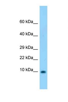 S100B / S100 Beta Antibody - S100B antibody Western blot of Rat Brain lysate. Antibody concentration 1 ug/ml.  This image was taken for the unconjugated form of this product. Other forms have not been tested.