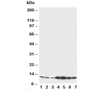 S100B / S100 Beta Antibody - Western blot testing of S100 beta antibody and Lane 1: rat brain; 2: rat brain; 3: MCF-7; 4: HeLa; 5: SMMC-7721; 6: Jurkat; 7: COLO320 cell lysate