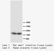 S100B / S100 Beta Antibody -  This image was taken for the unconjugated form of this product. Other forms have not been tested.