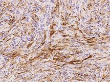 S100B / S100 Beta Antibody - Immunochemical staining of human S100B in human cerebellum with rabbit monoclonal antibody at 1:500 dilution, formalin-fixed paraffin embedded sections.