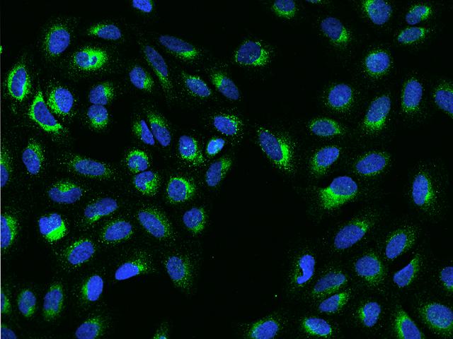 S100B / S100 Beta Antibody - Immunofluorescence staining of S100B in U2OS cells. Cells were fixed with 4% PFA, permeabilzed with 0.1% Triton X-100 in PBS, blocked with 10% serum, and incubated with rabbit anti-Human S100B monoclonal antibody (dilution ratio 1:60) at 4°C overnight. Then cells were stained with the Alexa Fluor 488-conjugated Goat Anti-rabbit IgG secondary antibody (green) and counterstained with DAPI (blue). Positive staining was localized to Cytoplasm.