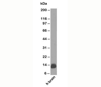 S100B / S100 Beta Antibody - Western blot testing of human samples using S100B antibody (clone 4C4.9). Predicted molecular weight: 12-15 kDa.