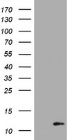 S100B / S100 Beta Antibody - HEK293T cells were transfected with the pCMV6-ENTRY control (Left lane) or pCMV6-ENTRY S100B (Right lane) cDNA for 48 hrs and lysed. Equivalent amounts of cell lysates (5 ug per lane) were separated by SDS-PAGE and immunoblotted with anti-S100B.