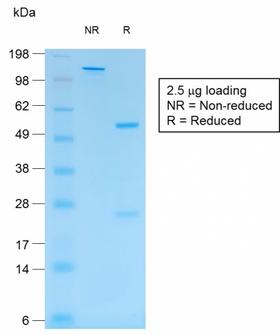 S100B / S100 Beta Antibody - SDS-PAGE Analysis Purified S100B Mouse Recombinant Monoclonal Antibody (rS100B/1012). Confirmation of Purity and Integrity of Antibody.