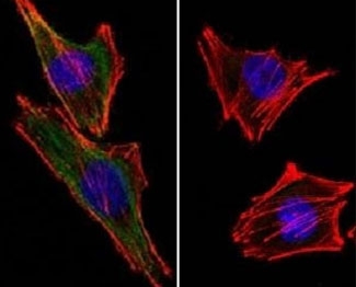S100B / S100 Beta Antibody - (Left) Confocal Immunofluorescent analysis of A2058 cells using AF488-labeled S100 beta antibody (green). F-actin filaments were labeled with DyLight 554 Phalloidin (red). DAPI was used to stain the cell nuclei (blue). (Right) Negative control.