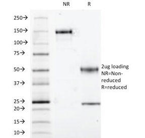 S100B / S100 Beta Antibody - SDS-PAGE Analysis of Purified, BSA-Free S100 beta Antibody (clone S100B/1012). Confirmation of Integrity and Purity of the Antibody.