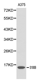 S100B / S100 Beta Antibody - Western blot of S100B pAb in extracts from A375 cells.