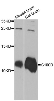 S100B / S100 Beta Antibody - Western blot analysis of extracts of various cell lines, using S100B antibody at 1:1000 dilution. The secondary antibody used was an HRP Goat Anti-Rabbit IgG (H+L) at 1:10000 dilution. Lysates were loaded 25ug per lane and 3% nonfat dry milk in TBST was used for blocking. An ECL Kit was used for detection and the exposure time was 10s.