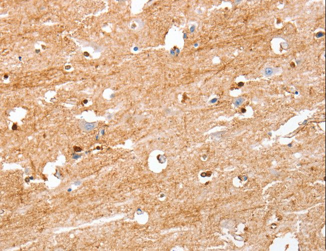 S100B / S100 Beta Antibody - Immunohistochemistry of paraffin-embedded Human brain using S100B Polyclonal Antibody at dilution of 1:50.