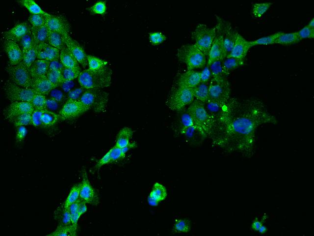S100B / S100 Beta Antibody - Immunofluorescence staining of S100B in A431 cells. Cells were fixed with 4% PFA, permeabilzed with 0.1% Triton X-100 in PBS, blocked with 10% serum, and incubated with rabbit anti-Human S100B polyclonal antibody (dilution ratio 1:200) at 4°C overnight. Then cells were stained with the Alexa Fluor 488-conjugated Goat Anti-rabbit IgG secondary antibody (green) and counterstained with DAPI (blue). Positive staining was localized to Cytoplasm.