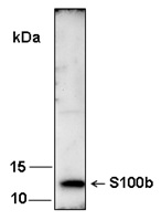 S100B / S100 Beta Antibody - Western blot analysis of recombinant human S100b using anti-S100b antibody (1 :1,000)