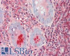 S100G / CABP9K Antibody - Human Small Intestine: Formalin-Fixed, Paraffin-Embedded (FFPE)