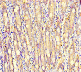 S100G / CABP9K Antibody - Immunohistochemistry of paraffin-embedded human small intestine tissue at dilution of 1:100